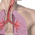 asthma.png